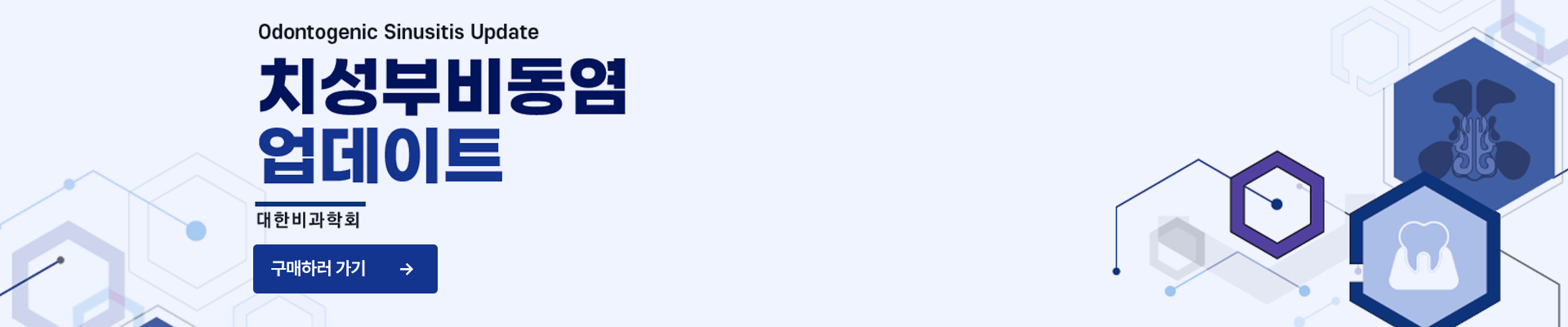 치성부비동염 업데이트
