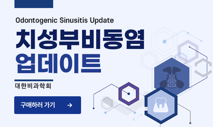 치성부비동염 업데이트